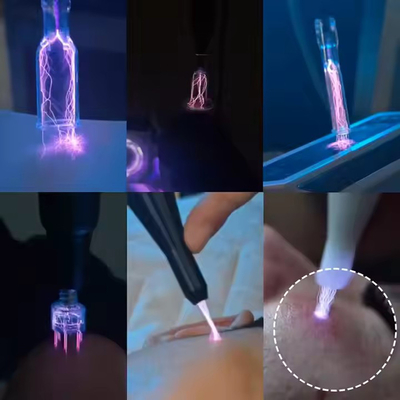 Cold Plasma Device Acne Treatment Machine Ozone Plasma Hair Growth Face Lifting Machine Cold Plasma Skin Rejuvenation Machine.