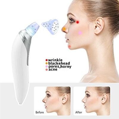 White Color Vacuum Microcrystalline Blackhead Remover For Teenager