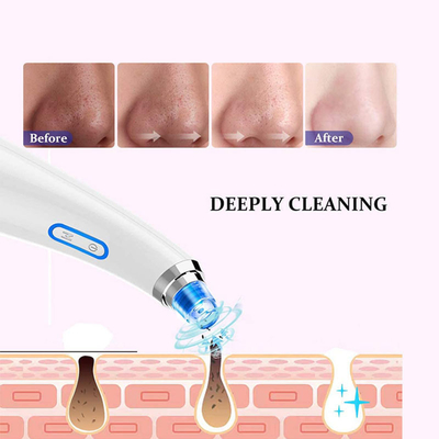 Vacuum Electric Suction Facial Comedo Acne Blackhead Remover Extractor Tool
