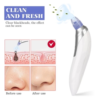 Microcrystalline head Blackhead Remover Pore Vacuum Cleaner  Black Head Whitehead Acne Removal